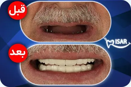 قیمت سکه امروز اول آبان ۱۴۰۵/ نیم سکه 141 میلیون و ۹۰۰ هزار تومان شد + جدول